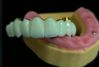 深圳市美牙牙義齒科技有限公司